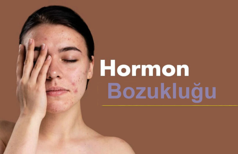 Hormon Bozukluğu Tedavisi - Op.Dr Emrah Kızıldağ Kadın Hastalıkları ve Doğum Uzmanı En İyi Kadın Doğum Doktoru yorumları Şişli İstanbul