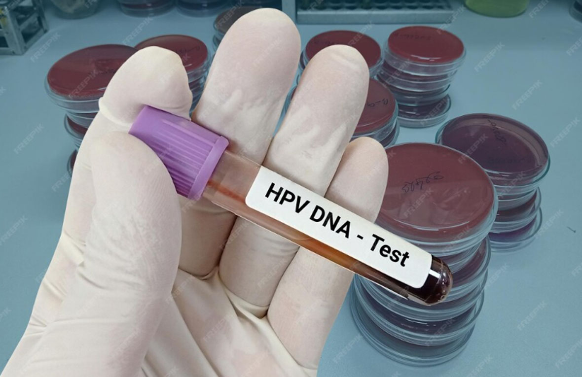 HPV Testi Op.Dr Emrah Kızıldağ Kadın Hastalıkları ve Doğum Uzmanı En İyi Kadın Doğum Doktoru yorumları Şişli İstanbul