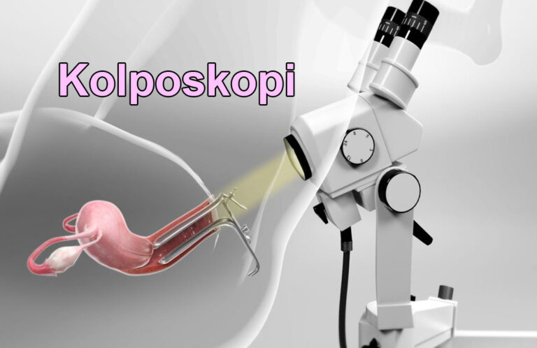 Kolposkopi Op.Dr Emrah Kızıldağ Kadın Hastalıkları ve Doğum Uzmanı Türkiye'nin en iyi kadın doğum doktoru yorumları Şişli İstanbul